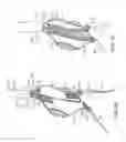 Fig. 07 - Stent graft delivery system