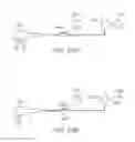Fig. 28 - Stent graft delivery system