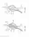 Fig. 44 - Stent graft delivery system