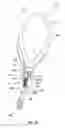 Fig. 03 - Systems and methods for implanting surgical implants