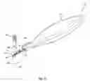 Fig. 04 - Systems and methods for implanting surgical implants