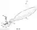 Fig. 05 - Systems and methods for implanting surgical implants