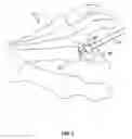 Fig. 07 - Systems and methods for implanting surgical implants