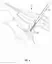 Fig. 08 - Systems and methods for implanting surgical implants