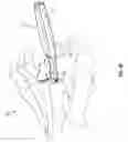 Fig. 10 - Systems and methods for implanting surgical implants