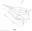 Fig. 12 - Systems and methods for implanting surgical implants