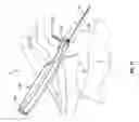 Fig. 16 - Systems and methods for implanting surgical implants