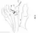 Fig. 17 - Systems and methods for implanting surgical implants