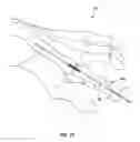 Fig. 19 - Systems and methods for implanting surgical implants