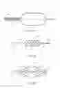 Fig. 09 - Anchoring delivery system and methods