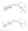 Fig. 35 - Anchoring delivery system and methods