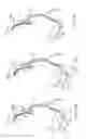 Fig. 45 - Anchoring delivery system and methods