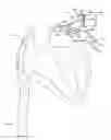 Fig. 01 - Multi-Lumen Catheter for Cardiac Device Deployment