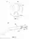 Fig. 02 - Multi-Lumen Catheter for Cardiac Device Deployment