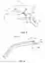 Fig. 03 - Multi-Lumen Catheter for Cardiac Device Deployment