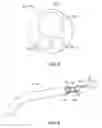 Fig. 04 - Multi-Lumen Catheter for Cardiac Device Deployment