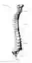 Fig. 02 - ENDOSCOPIC INFLATABLE ABRADING DEVICE FOR SPINAL DISC REMOVAL