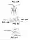 Fig. 07 - Apparatuses and methods for cutting a tissue bridge and/or removing a heart valve clip or suture