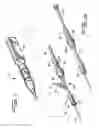 Fig. 02 - ROTATIONAL THROMBECTOMY WIRE