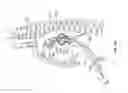 Fig. 09 - Diaphragm entry for posterior surgical access