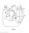 Fig. 35 - Diaphragm entry for posterior surgical access