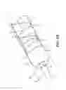 Fig. 09 - Device for medical lead extraction