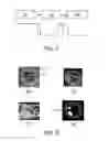 Fig. 06 - DEVICE AND METHOD FOR ASSISTING IN TISSUE ABLATION