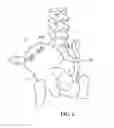 Fig. 07 - Implants and methods for cosmetic surgery