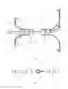 Fig. 02 - Airway stent