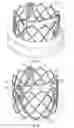 Fig. 02 - Prosthetic heart valve