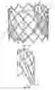 Fig. 09 - Prosthetic heart valve