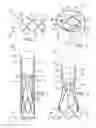 Fig. 02 - Retaining mechanisms for prosthetic valves