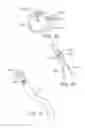 Fig. 17 - Retaining mechanisms for prosthetic valves