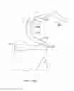 Fig. 49 - Systems and methods for providing a femoral component with a modified posterior condyle