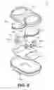 Fig. 08 - SYSTEMS AND METHODS FOR MEASURING PERFORMANCE PARAMETERS RELATED TO ORTHOPEDIC ARTHROPLASTY