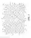 Fig. 04 - Stent