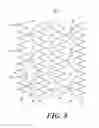 Fig. 09 - Stent