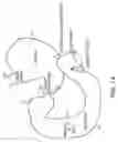 Fig. 02 - DEVICES AND METHODS FOR PLACING A GASTROINTESTINAL DEVICE