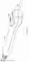 Fig. 46 - DEVICES AND METHODS FOR PLACING A GASTROINTESTINAL DEVICE