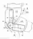 Fig. 01 - Protective sleeve and treatment method thereof