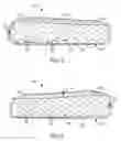 Fig. 04 - CPAP PILLOW APPARATUS AND METHOD