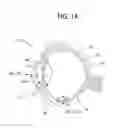 Fig. 02 - Methods and devices for drug delivery to ocular tissue using microneedle