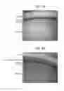 Fig. 10 - Methods and devices for drug delivery to ocular tissue using microneedle
