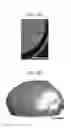 Fig. 12 - Methods and devices for drug delivery to ocular tissue using microneedle