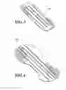Fig. 04 - Fastener for an absorbent article