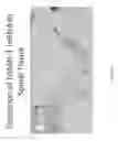 Fig. 06 - CNS delivery of MRNA and uses thereof