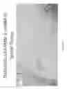 Fig. 41 - CNS delivery of MRNA and uses thereof