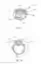 Fig. 06 - Medicinal solution to be continuously or pulse-delivered to the eye for treating ophthalmological conditions/maladies