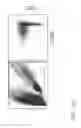 Fig. 40 - Engineering and delivery of therapeutic compositions of freshly isolated cells