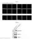 Fig. 07 - NOVEL RECOMBINANT EXOSOME AND USE THEREOF